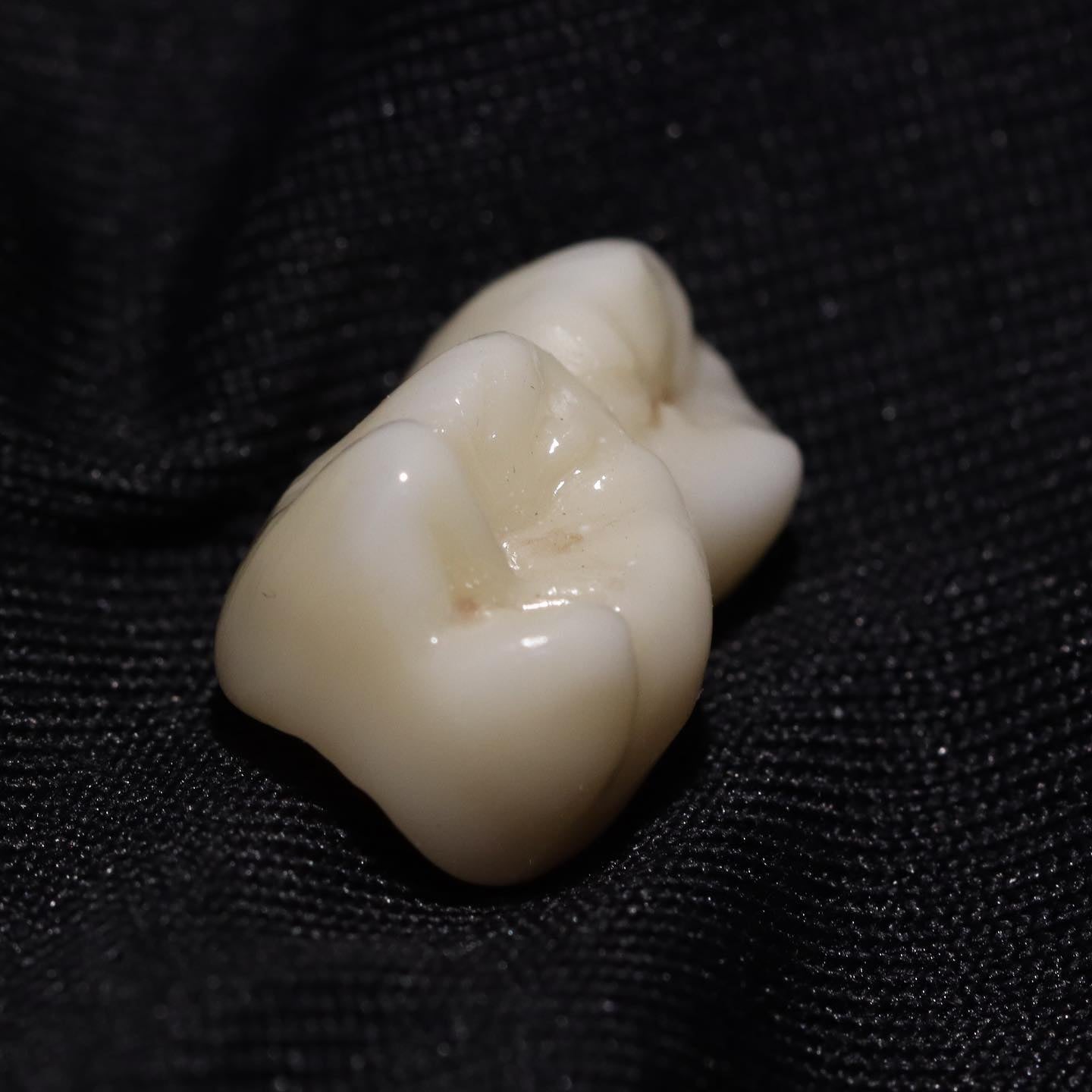 Prótesis dental profesional